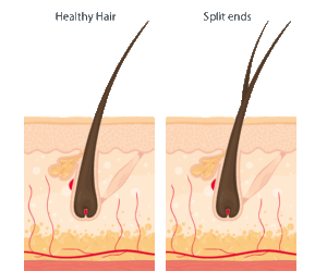 hairs split ends