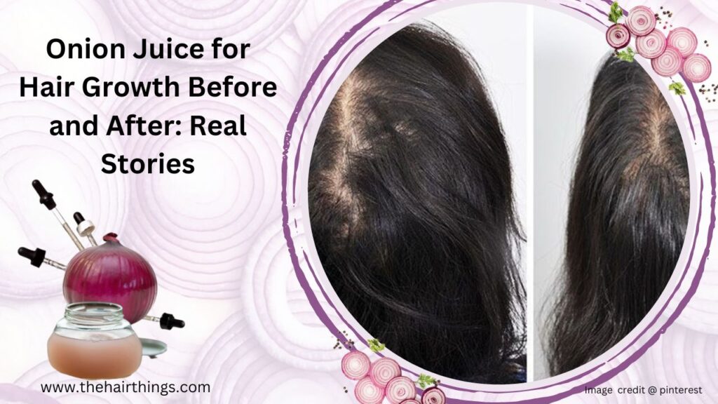 Onion Juice for Hair Growth Before and After: Real Stories