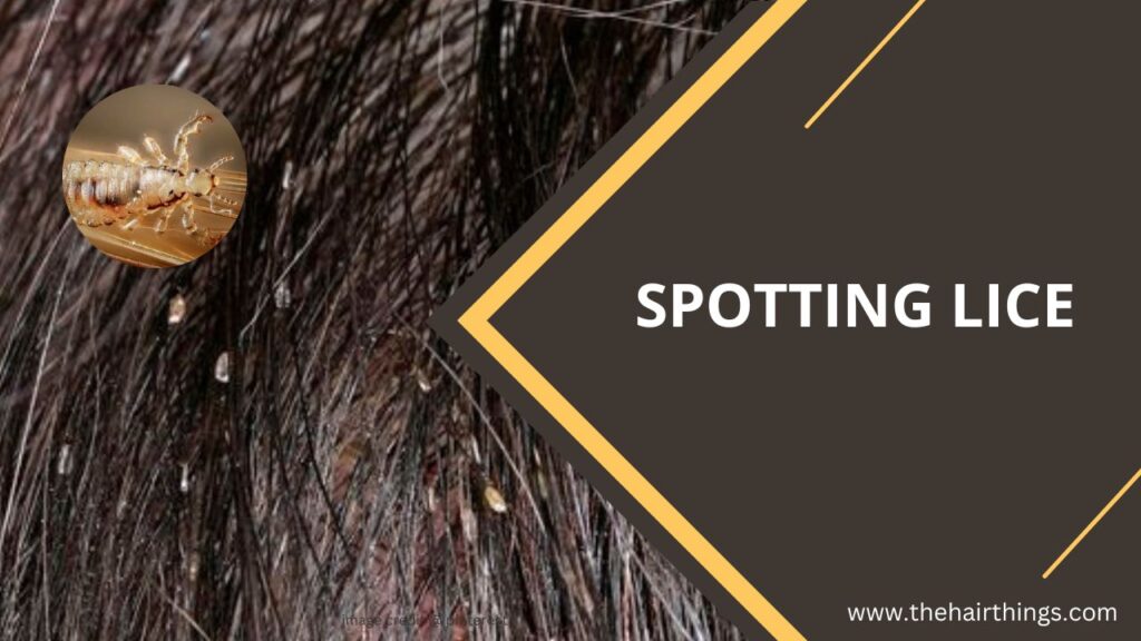 Spotting Lice