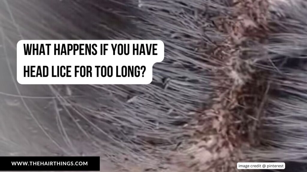 What Happens if You Have Head Lice for Too Long?